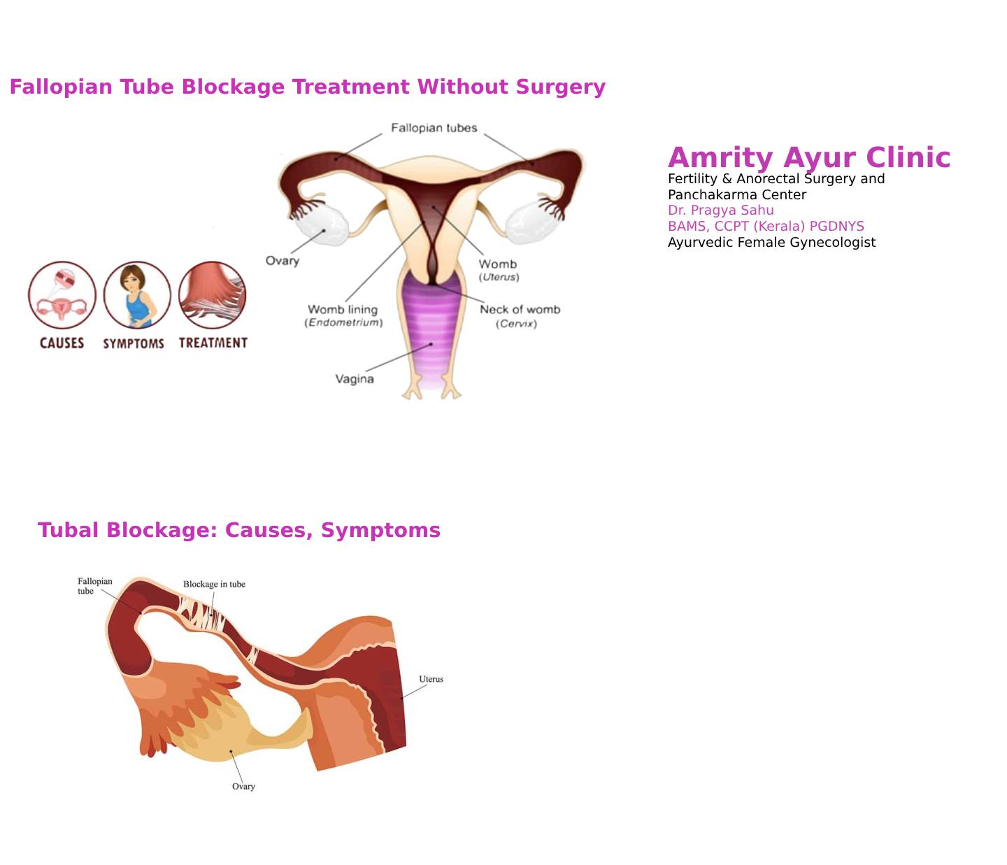 tubal blockage
